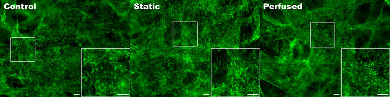 3D brain tri-culture model comprising neurons, astrocytes and microglia