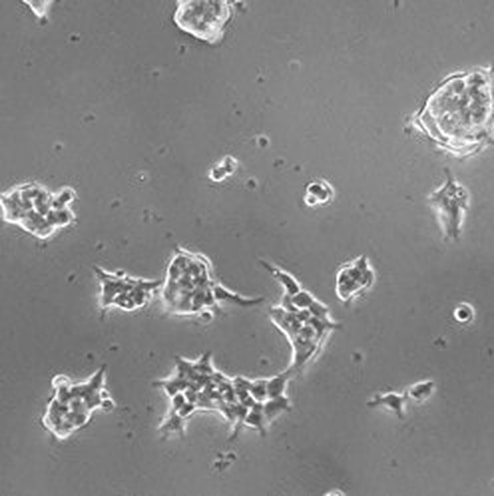 Non-small cell lung carcinoma organoids cultured on the Blood Substitute (day 1 photo)